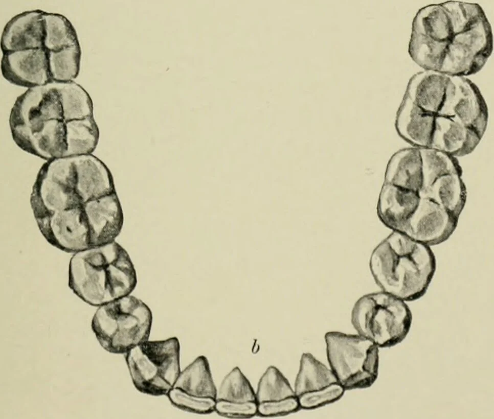 An illustration from Atlas and text-book of dentistry including diseases of the mouth / by Gustav Preiswerk. Edited by George W. Warren., 1906, leaf 85