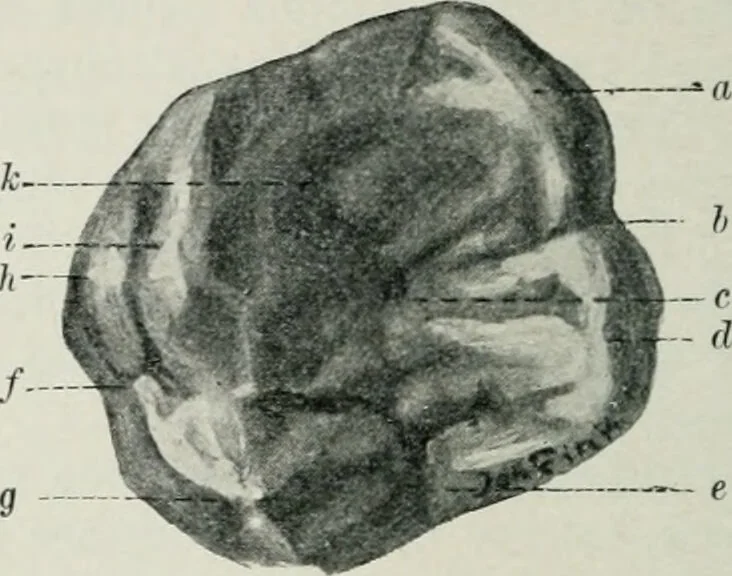 An illustration from Atlas and text-book of dentistry including diseases of the mouth / by Gustav Preiswerk. Edited by George W. Warren., 1906, leaf 88