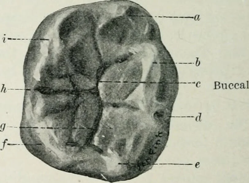 An illustration from Atlas and text-book of dentistry including diseases of the mouth / by Gustav Preiswerk. Edited by George W. Warren., 1906, leaf 88
