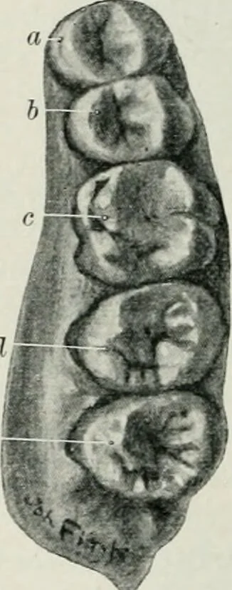 An illustration from Atlas and text-book of dentistry including diseases of the mouth / by Gustav Preiswerk. Edited by George W. Warren., 1906, leaf 90
