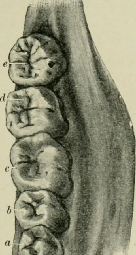An illustration from Atlas and text-book of dentistry including diseases of the mouth / by Gustav Preiswerk. Edited by George W. Warren., 1906, leaf 91