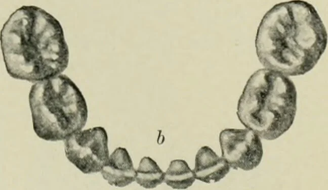 An illustration from Atlas and text-book of dentistry including diseases of the mouth / by Gustav Preiswerk. Edited by George W. Warren., 1906, leaf 93