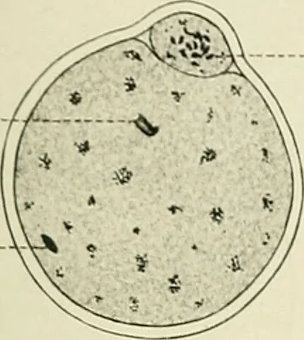 An illustration from Obstetrics : a text-book for the use of students and practitioners / by J. Whitridge Williams ... with eight coloured plates and six hundred and thirty illustrations in the text., 1903, leaf 117