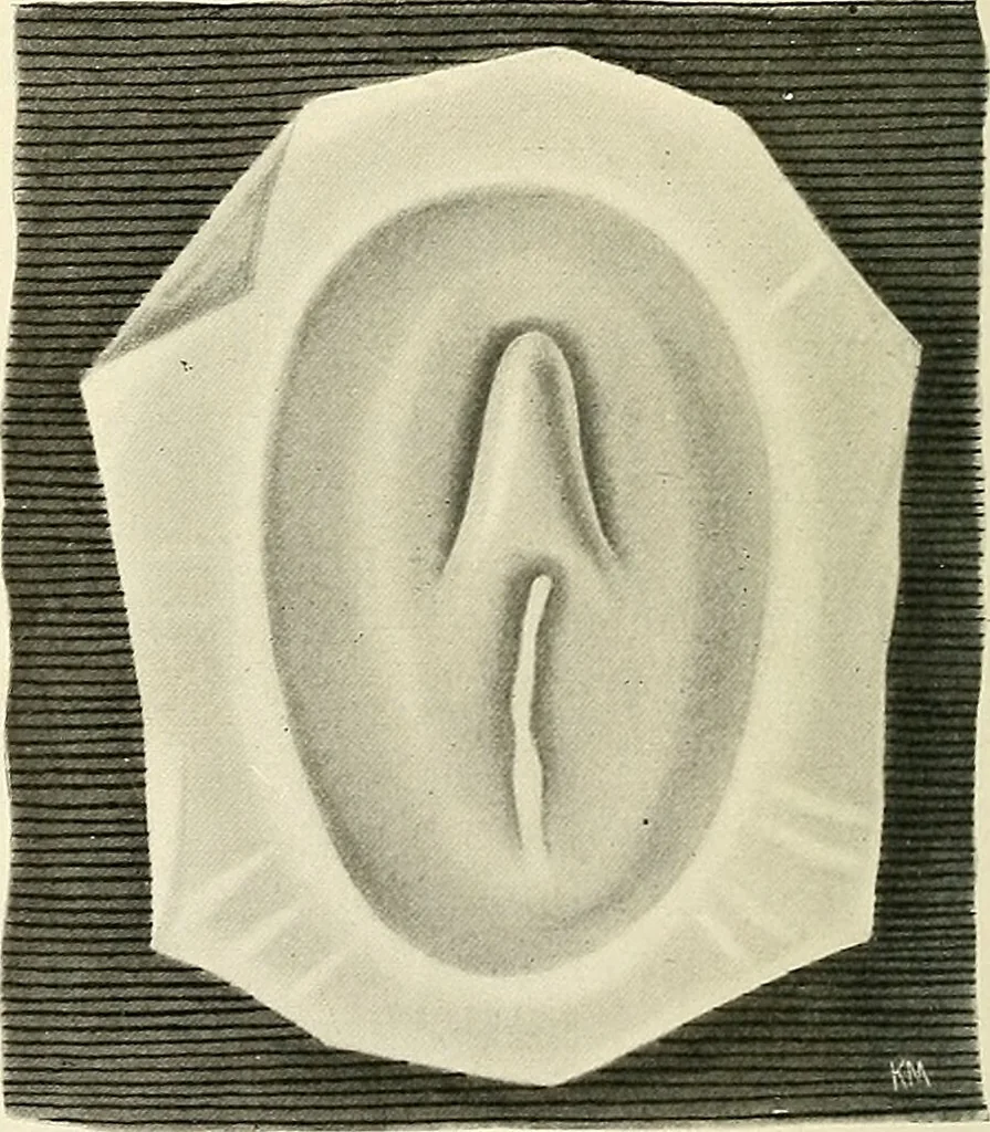 An illustration from Obstetrics : a text-book for the use of students and practitioners / by J. Whitridge Williams ... with eight coloured plates and six hundred and thirty illustrations in the text., 1903, leaf 122