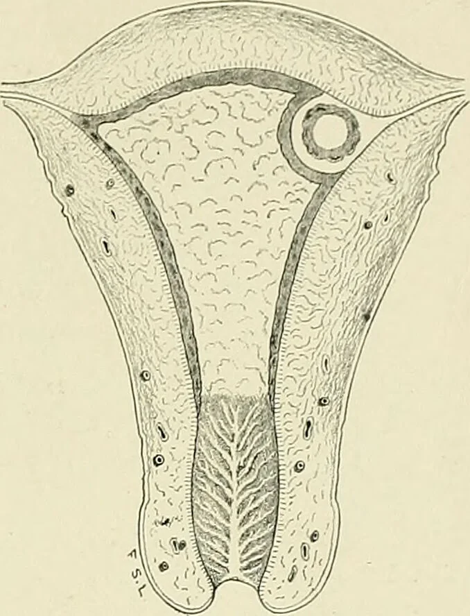 An illustration from Obstetrics : a text-book for the use of students and practitioners / by J. Whitridge Williams ... with eight coloured plates and six hundred and thirty illustrations in the text., 1903, leaf 139