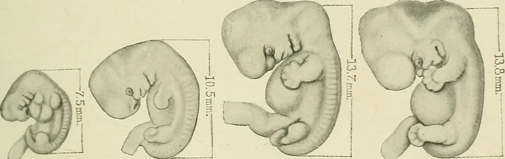 An illustration from Obstetrics : a text-book for the use of students and practitioners / by J. Whitridge Williams ... with eight coloured plates and six hundred and thirty illustrations in the text., 1903, leaf 169