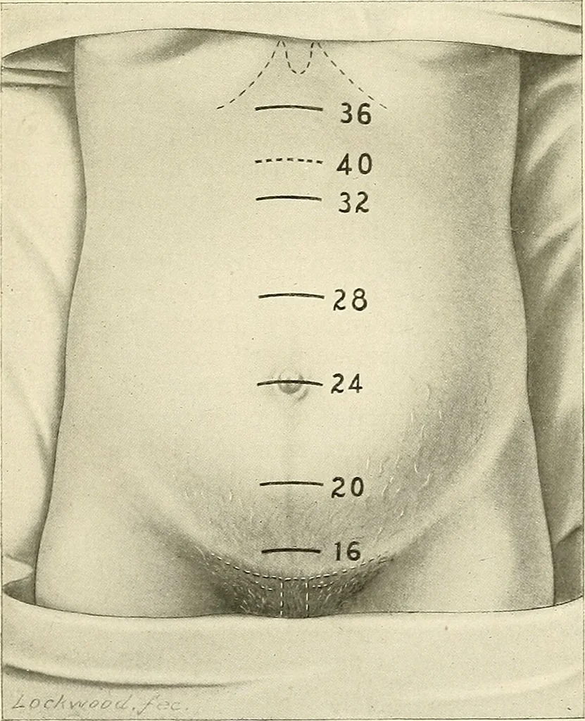 An illustration from Obstetrics : a text-book for the use of students and practitioners / by J. Whitridge Williams ... with eight coloured plates and six hundred and thirty illustrations in the text., 1903, leaf 214