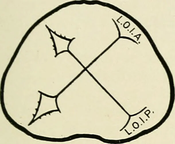 An illustration from Obstetrics : a text-book for the use of students and practitioners / by J. Whitridge Williams ... with eight coloured plates and six hundred and thirty illustrations in the text., 1903, leaf 225