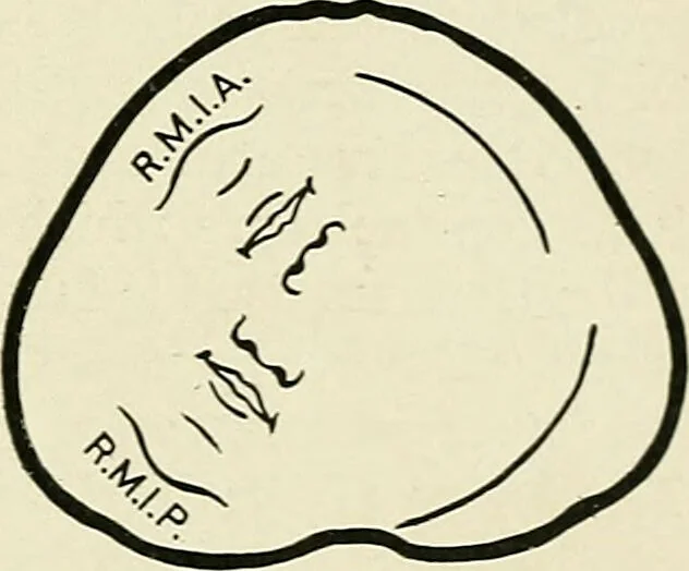 An illustration from Obstetrics : a text-book for the use of students and practitioners / by J. Whitridge Williams ... with eight coloured plates and six hundred and thirty illustrations in the text., 1903, leaf 225