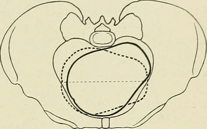 An illustration from Obstetrics : a text-book for the use of students and practitioners / by J. Whitridge Williams ... with eight coloured plates and six hundred and thirty illustrations in the text., 1903, leaf 277