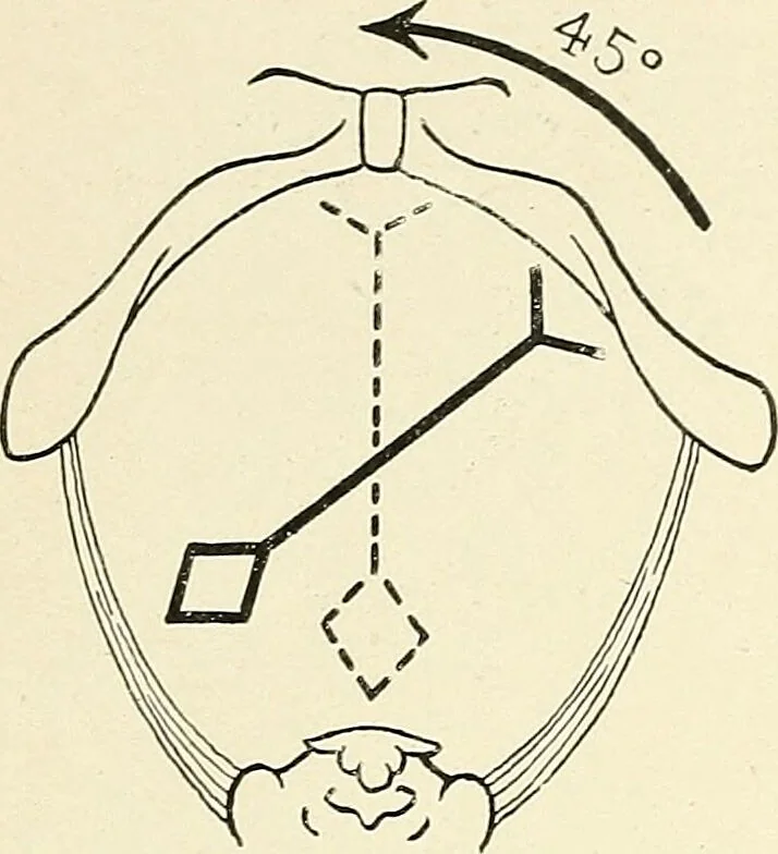 An illustration from Obstetrics : a text-book for the use of students and practitioners / by J. Whitridge Williams ... with eight coloured plates and six hundred and thirty illustrations in the text., 1903, leaf 280