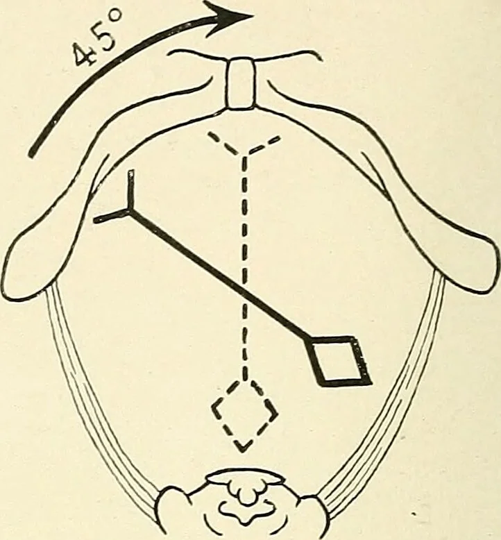 An illustration from Obstetrics : a text-book for the use of students and practitioners / by J. Whitridge Williams ... with eight coloured plates and six hundred and thirty illustrations in the text., 1903, leaf 280
