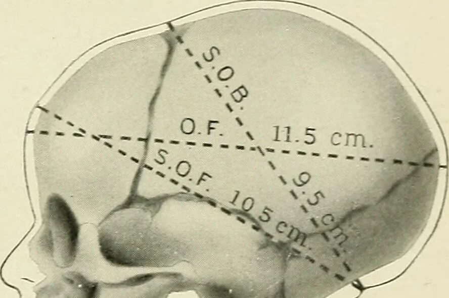 An illustration from Obstetrics : a text-book for the use of students and practitioners / by J. Whitridge Williams ... with eight coloured plates and six hundred and thirty illustrations in the text., 1903, leaf 281