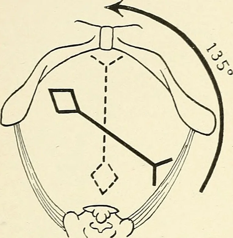 An illustration from Obstetrics : a text-book for the use of students and practitioners / by J. Whitridge Williams ... with eight coloured plates and six hundred and thirty illustrations in the text., 1903, leaf 288