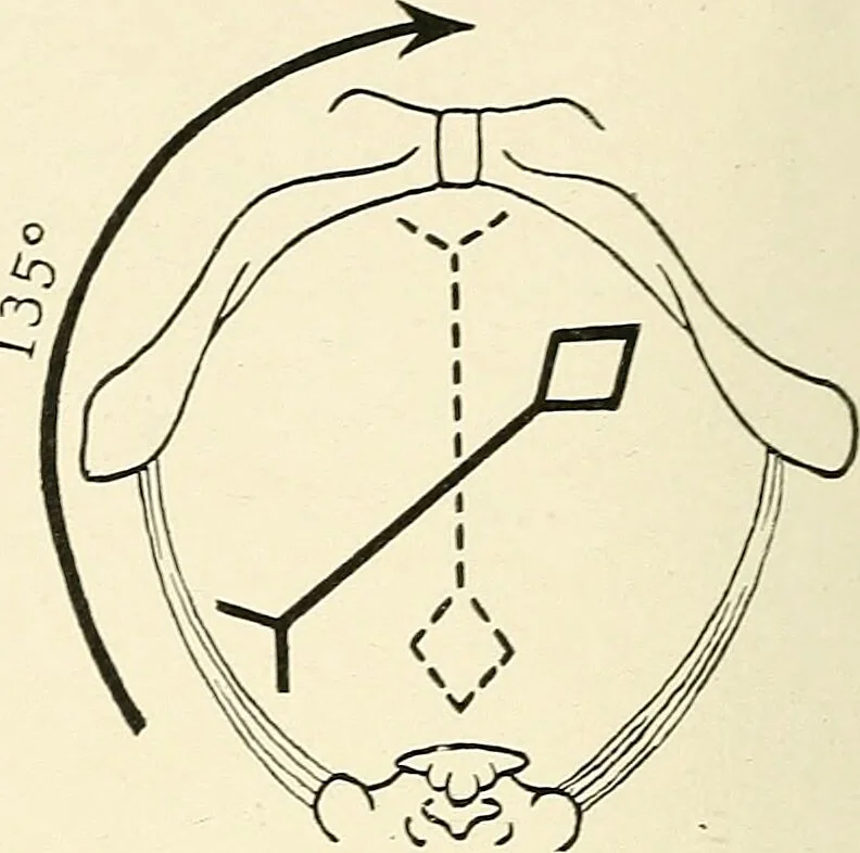 An illustration from Obstetrics : a text-book for the use of students and practitioners / by J. Whitridge Williams ... with eight coloured plates and six hundred and thirty illustrations in the text., 1903, leaf 288