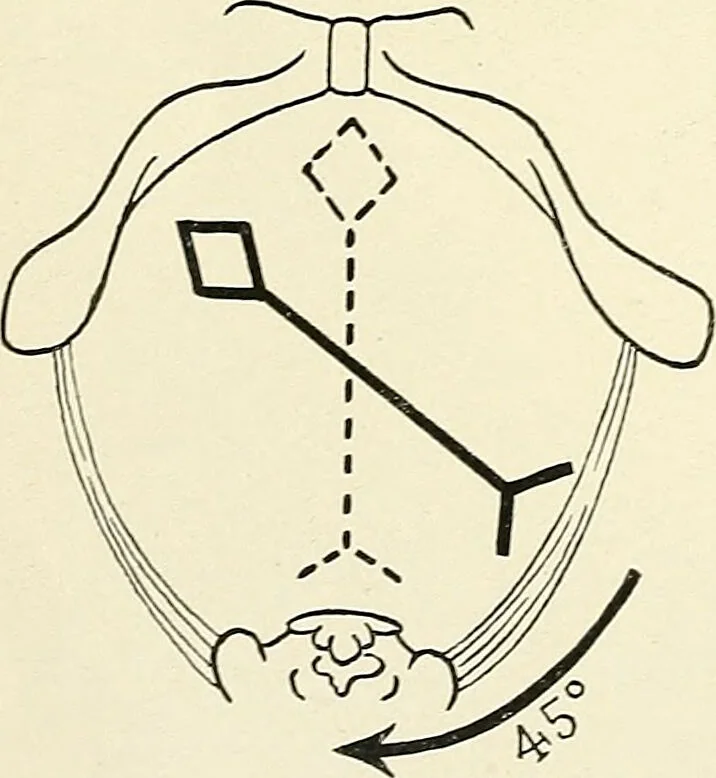 An illustration from Obstetrics : a text-book for the use of students and practitioners / by J. Whitridge Williams ... with eight coloured plates and six hundred and thirty illustrations in the text., 1903, leaf 288