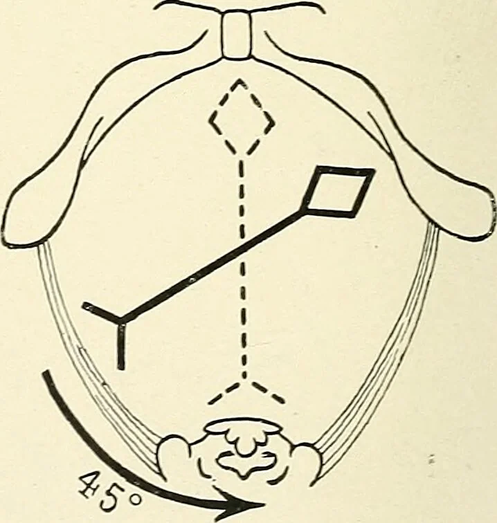 An illustration from Obstetrics : a text-book for the use of students and practitioners / by J. Whitridge Williams ... with eight coloured plates and six hundred and thirty illustrations in the text., 1903, leaf 288