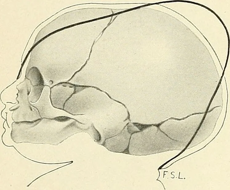 An illustration from Obstetrics : a text-book for the use of students and practitioners / by J. Whitridge Williams ... with eight coloured plates and six hundred and thirty illustrations in the text., 1903, leaf 292