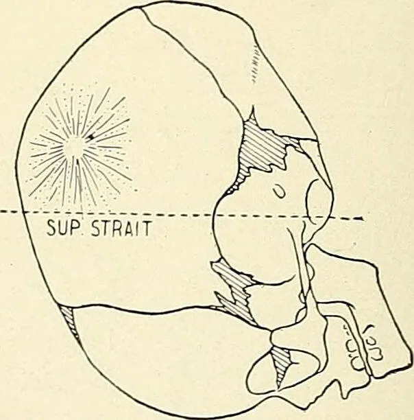 An illustration from Obstetrics : a text-book for the use of students and practitioners / by J. Whitridge Williams ... with eight coloured plates and six hundred and thirty illustrations in the text., 1903, leaf 302