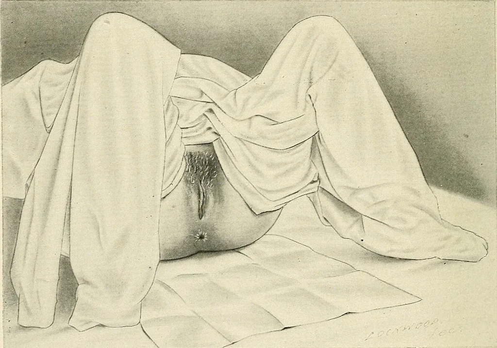 An illustration from Obstetrics : a text-book for the use of students and practitioners / by J. Whitridge Williams ... with eight coloured plates and six hundred and thirty illustrations in the text., 1903, leaf 332