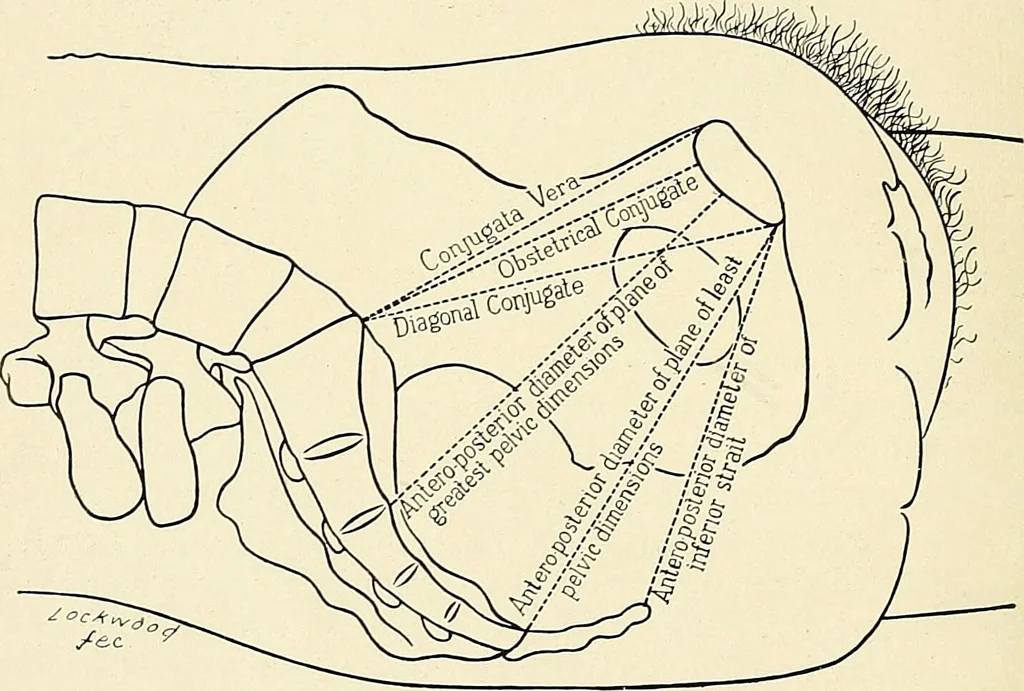 An illustration from Obstetrics : a text-book for the use of students and practitioners / by J. Whitridge Williams ... with eight coloured plates and six hundred and thirty illustrations in the text., 1903, leaf 34