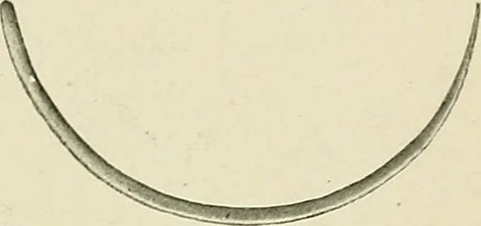 An illustration from Obstetrics : a text-book for the use of students and practitioners / by J. Whitridge Williams ... with eight coloured plates and six hundred and thirty illustrations in the text., 1903, leaf 349