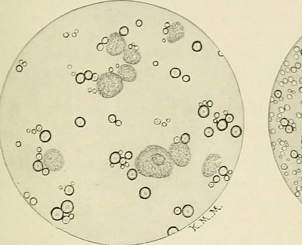 An illustration from Obstetrics : a text-book for the use of students and practitioners / by J. Whitridge Williams ... with eight coloured plates and six hundred and thirty illustrations in the text., 1903, leaf 371