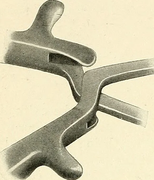 An illustration from Obstetrics : a text-book for the use of students and practitioners / by J. Whitridge Williams ... with eight coloured plates and six hundred and thirty illustrations in the text., 1903, leaf 404