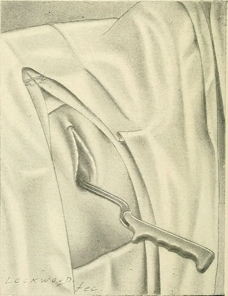 An illustration from Obstetrics : a text-book for the use of students and practitioners / by J. Whitridge Williams ... with eight coloured plates and six hundred and thirty illustrations in the text., 1903, leaf 414