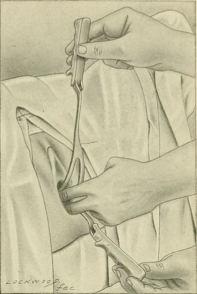 An illustration from Obstetrics : a text-book for the use of students and practitioners / by J. Whitridge Williams ... with eight coloured plates and six hundred and thirty illustrations in the text., 1903, leaf 415