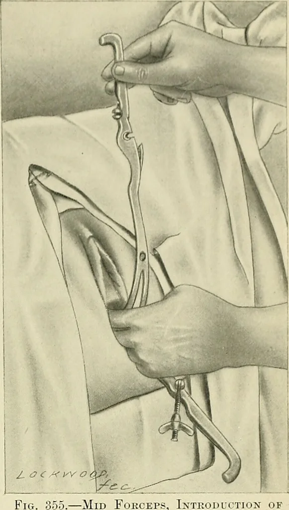 An illustration from Obstetrics : a text-book for the use of students and practitioners / by J. Whitridge Williams ... with eight coloured plates and six hundred and thirty illustrations in the text., 1903, leaf 419