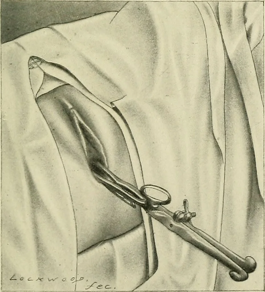An illustration from Obstetrics : a text-book for the use of students and practitioners / by J. Whitridge Williams ... with eight coloured plates and six hundred and thirty illustrations in the text., 1903, leaf 419