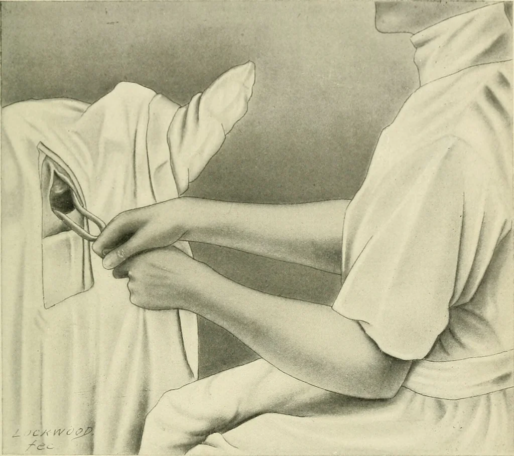 An illustration from Obstetrics : a text-book for the use of students and practitioners / by J. Whitridge Williams ... with eight coloured plates and six hundred and thirty illustrations in the text., 1903, leaf 421