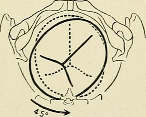 An illustration from Obstetrics : a text-book for the use of students and practitioners / by J. Whitridge Williams ... with eight coloured plates and six hundred and thirty illustrations in the text., 1903, leaf 421