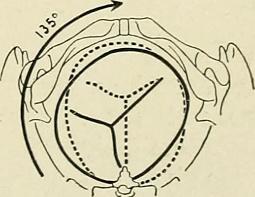 An illustration from Obstetrics : a text-book for the use of students and practitioners / by J. Whitridge Williams ... with eight coloured plates and six hundred and thirty illustrations in the text., 1903, leaf 421