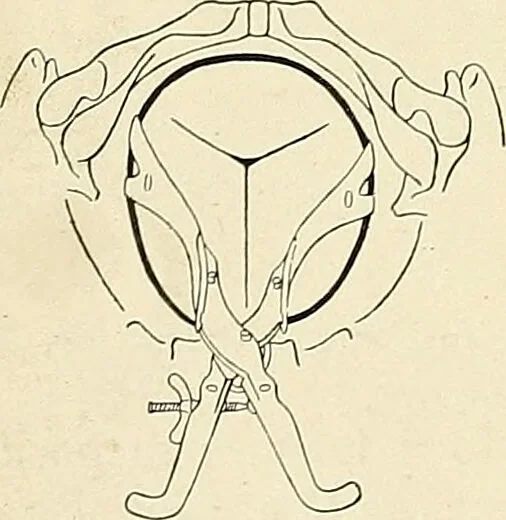 An illustration from Obstetrics : a text-book for the use of students and practitioners / by J. Whitridge Williams ... with eight coloured plates and six hundred and thirty illustrations in the text., 1903, leaf 422