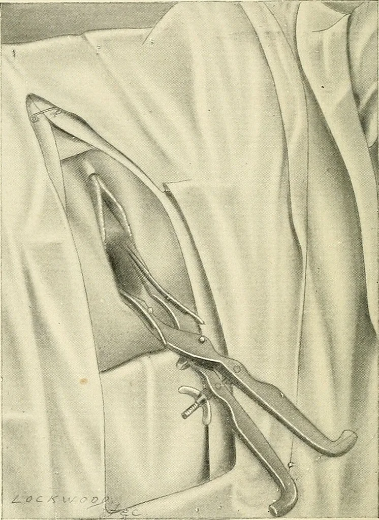 An illustration from Obstetrics : a text-book for the use of students and practitioners / by J. Whitridge Williams ... with eight coloured plates and six hundred and thirty illustrations in the text., 1903, leaf 422