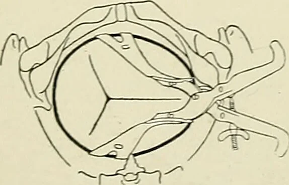An illustration from Obstetrics : a text-book for the use of students and practitioners / by J. Whitridge Williams ... with eight coloured plates and six hundred and thirty illustrations in the text., 1903, leaf 423