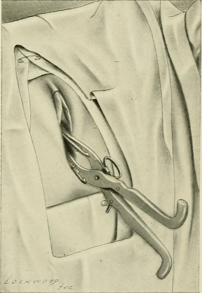 An illustration from Obstetrics : a text-book for the use of students and practitioners / by J. Whitridge Williams ... with eight coloured plates and six hundred and thirty illustrations in the text., 1903, leaf 423