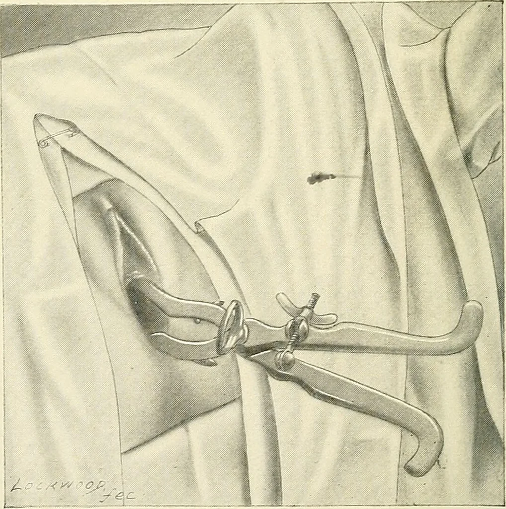 An illustration from Obstetrics : a text-book for the use of students and practitioners / by J. Whitridge Williams ... with eight coloured plates and six hundred and thirty illustrations in the text., 1903, leaf 424