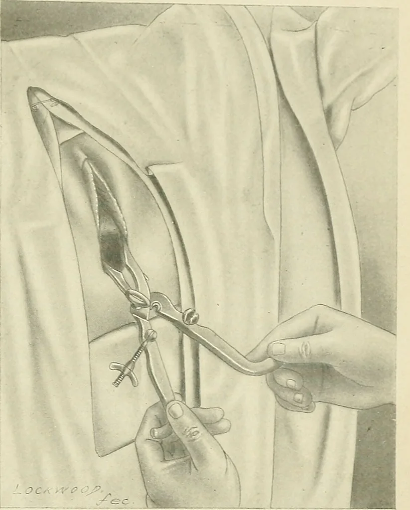 An illustration from Obstetrics : a text-book for the use of students and practitioners / by J. Whitridge Williams ... with eight coloured plates and six hundred and thirty illustrations in the text., 1903, leaf 425