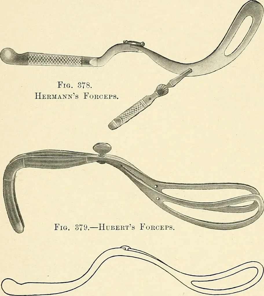 An illustration from Obstetrics : a text-book for the use of students and practitioners / by J. Whitridge Williams ... with eight coloured plates and six hundred and thirty illustrations in the text., 1903, leaf 428