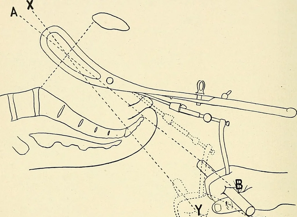 An illustration from Obstetrics : a text-book for the use of students and practitioners / by J. Whitridge Williams ... with eight coloured plates and six hundred and thirty illustrations in the text., 1903, leaf 430