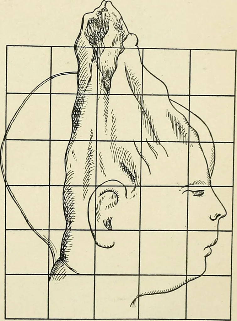 An illustration from Obstetrics : a text-book for the use of students and practitioners / by J. Whitridge Williams ... with eight coloured plates and six hundred and thirty illustrations in the text., 1903, leaf 473