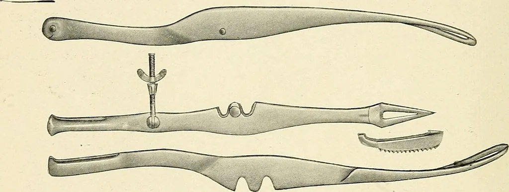 An illustration from Obstetrics : a text-book for the use of students and practitioners / by J. Whitridge Williams ... with eight coloured plates and six hundred and thirty illustrations in the text., 1903, leaf 474