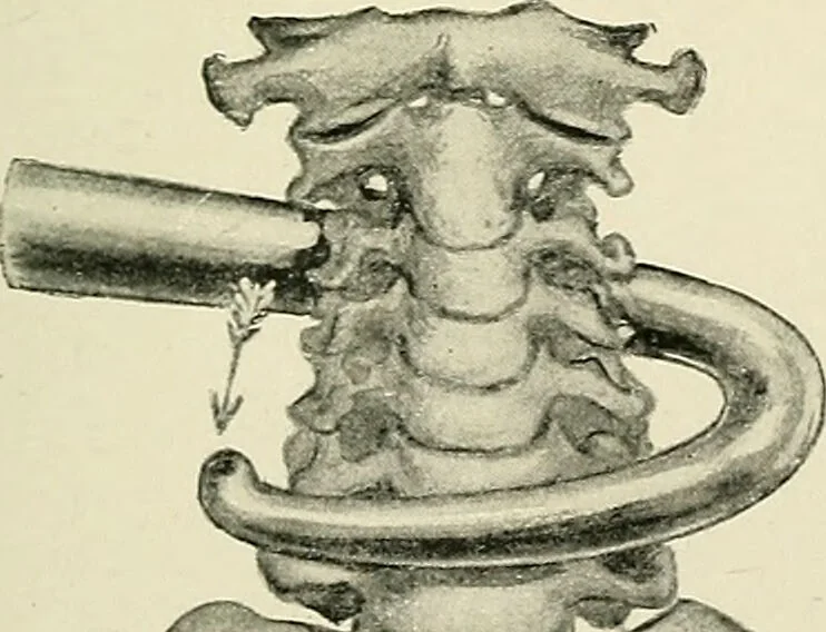 An illustration from Obstetrics : a text-book for the use of students and practitioners / by J. Whitridge Williams ... with eight coloured plates and six hundred and thirty illustrations in the text., 1903, leaf 477
