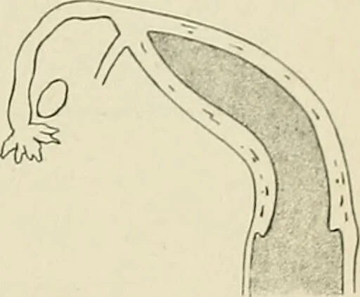 An illustration from Obstetrics : a text-book for the use of students and practitioners / by J. Whitridge Williams ... with eight coloured plates and six hundred and thirty illustrations in the text., 1903, leaf 521