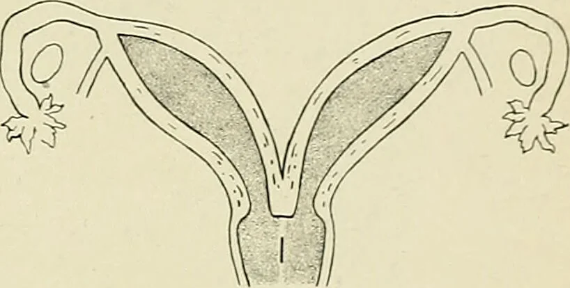 An illustration from Obstetrics : a text-book for the use of students and practitioners / by J. Whitridge Williams ... with eight coloured plates and six hundred and thirty illustrations in the text., 1903, leaf 521