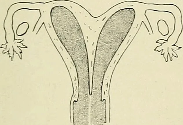 An illustration from Obstetrics : a text-book for the use of students and practitioners / by J. Whitridge Williams ... with eight coloured plates and six hundred and thirty illustrations in the text., 1903, leaf 521