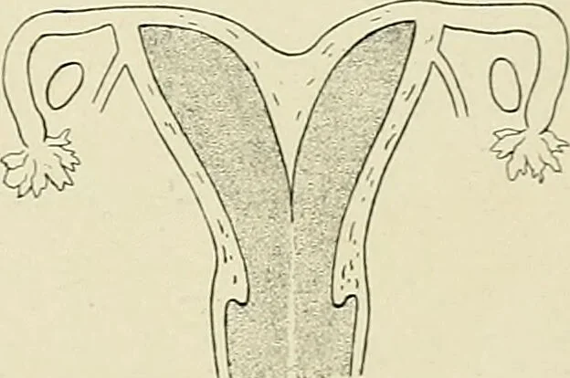 An illustration from Obstetrics : a text-book for the use of students and practitioners / by J. Whitridge Williams ... with eight coloured plates and six hundred and thirty illustrations in the text., 1903, leaf 521